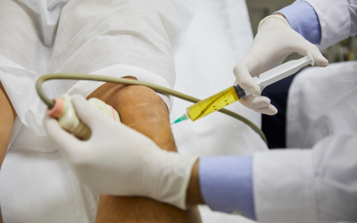 Stem Cell Therapy for Joint Pain