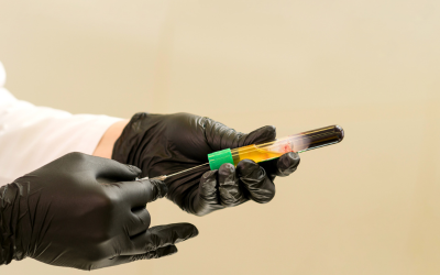 How PRP Injections Work in Regenerative Wellness