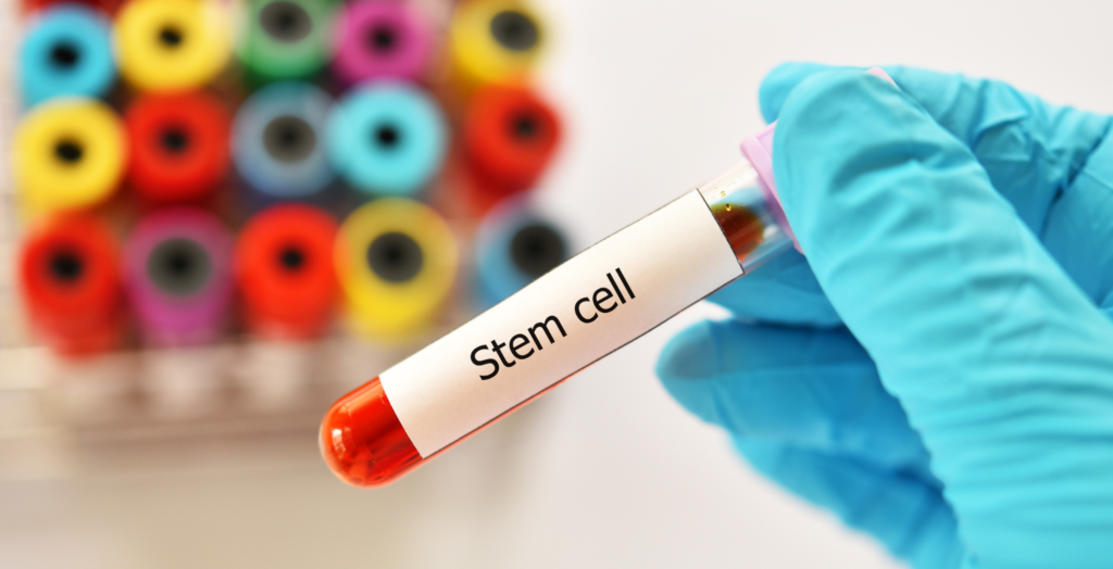 Stem Cells