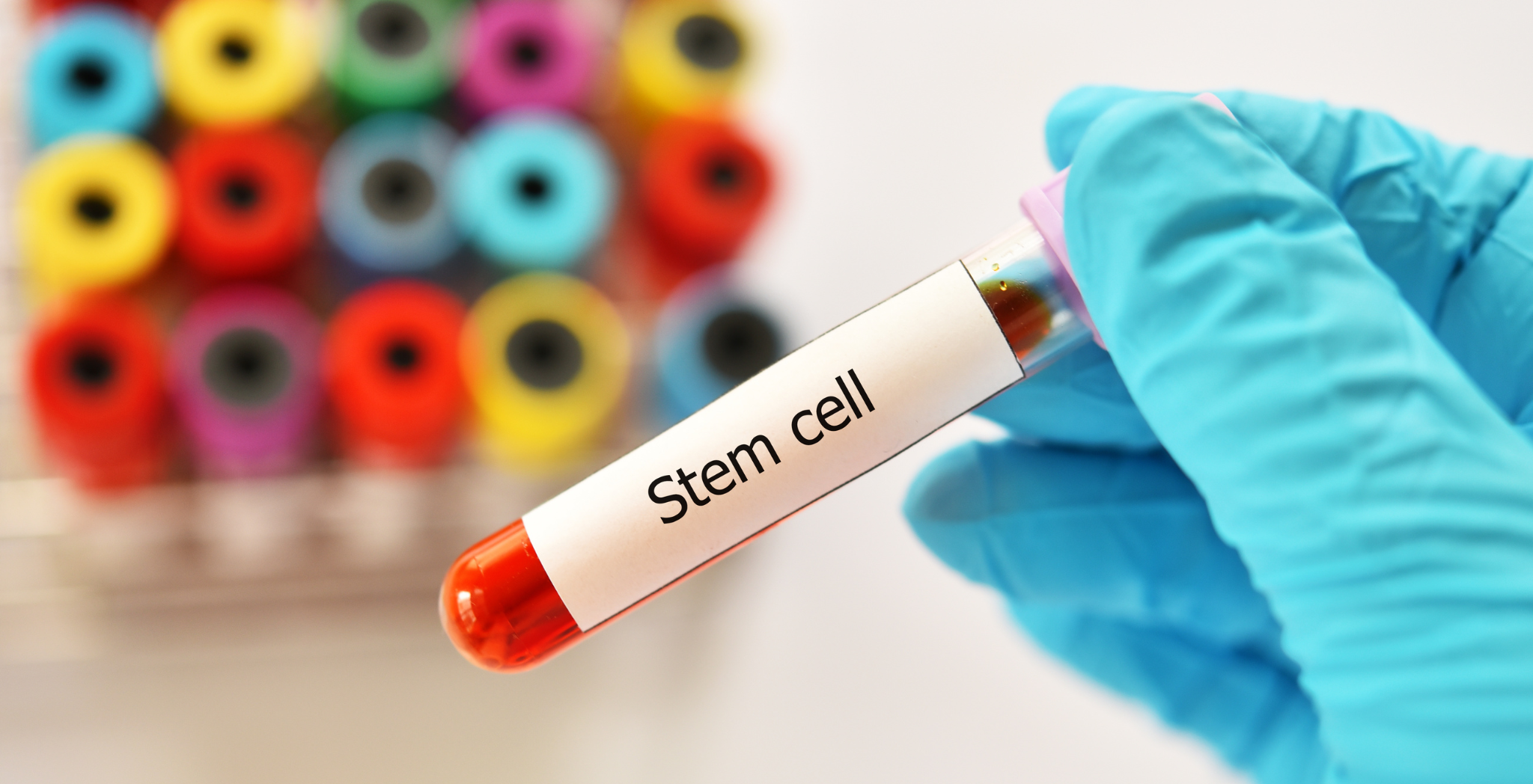Stem Cells