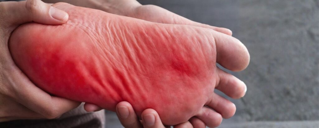 What Is Stem Cell Treatment for Neuropathy