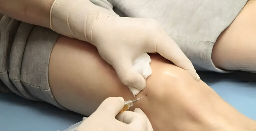 Cellular Regeneration Therapy Benefits & Uses