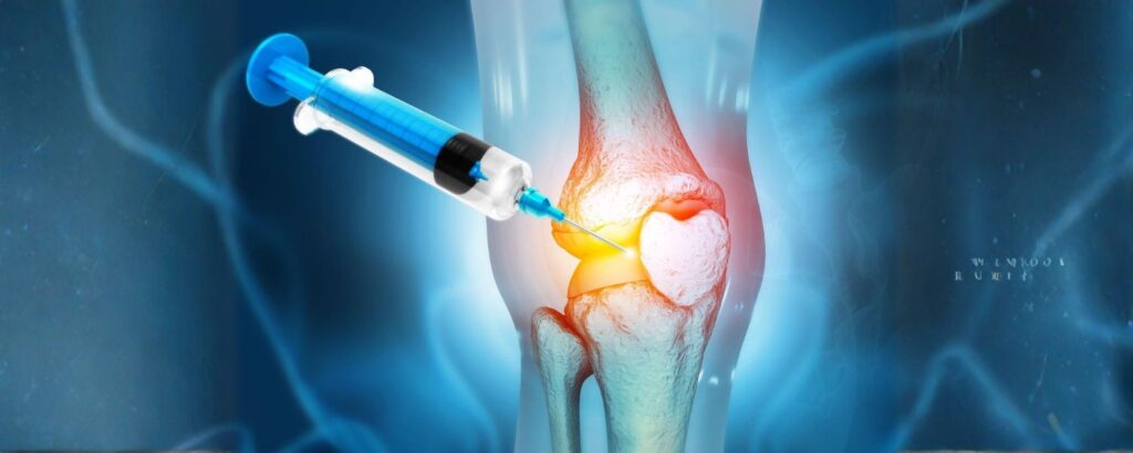 Benefits of Regenerative Sports Medicine