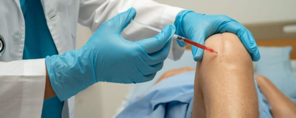 Regenerative Sports Medicine