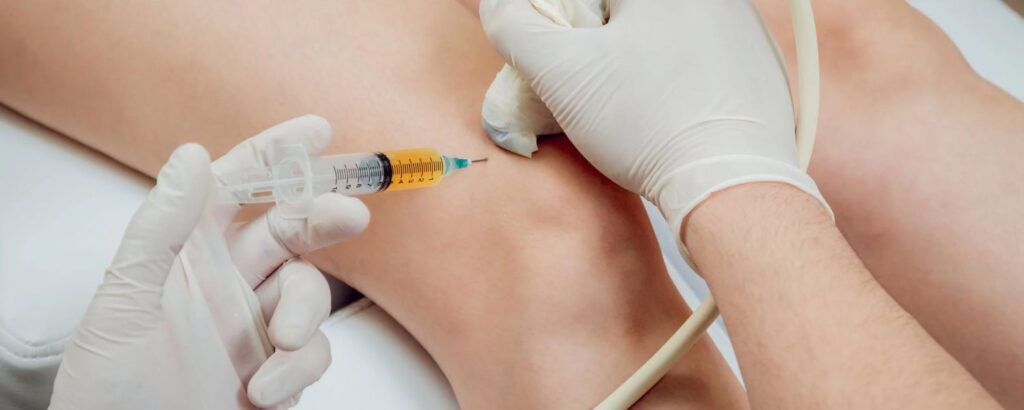 Benefit from Regenerative Sports Medicine