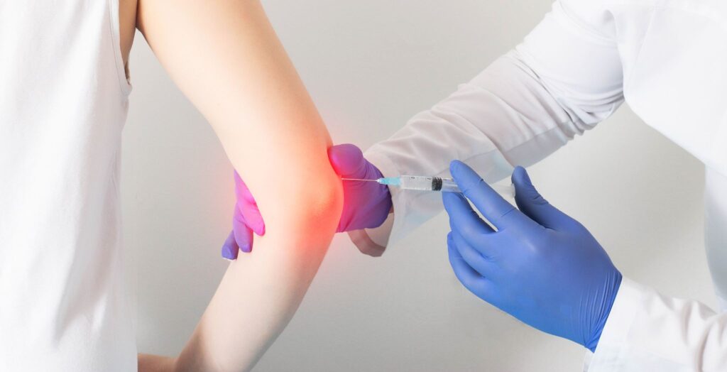 Injection-for-Arthritis